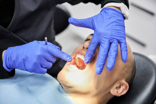 Best Emergency Treatment for Oral Infections in Hoover, AL